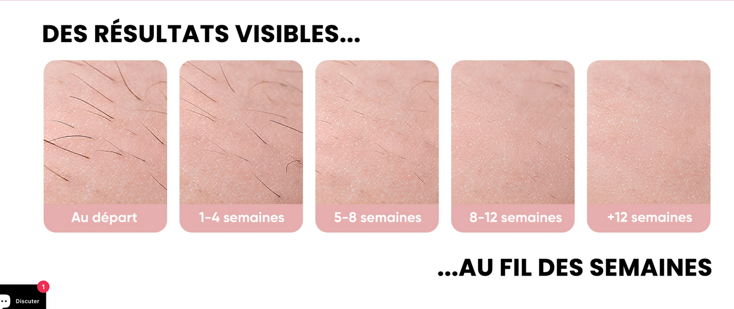 ✨ BREECOZYN LumiFace Pro Épilateur de Peau à lumière pulsée ✨