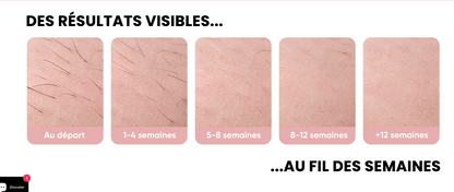 ✨ BREECOZYN LumiFace Pro Épilateur de Peau à lumière pulsée ✨